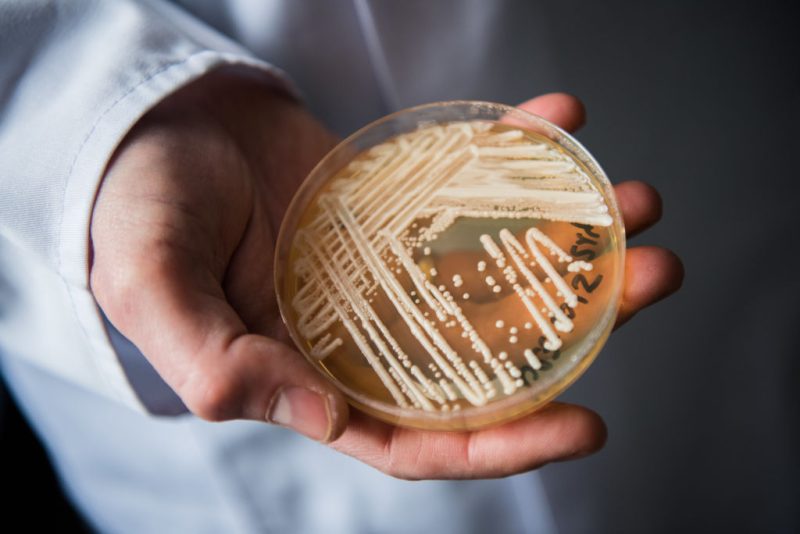 Candida auris Confirmed in 23 States as 2026 Outbreak Spreads