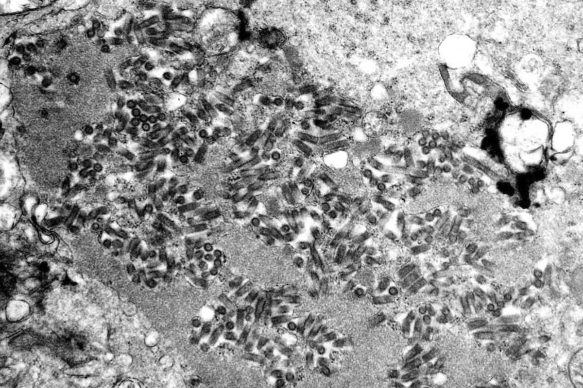 CDC Warns of Rising Rabies Exposures and Treatment Errors This Summer