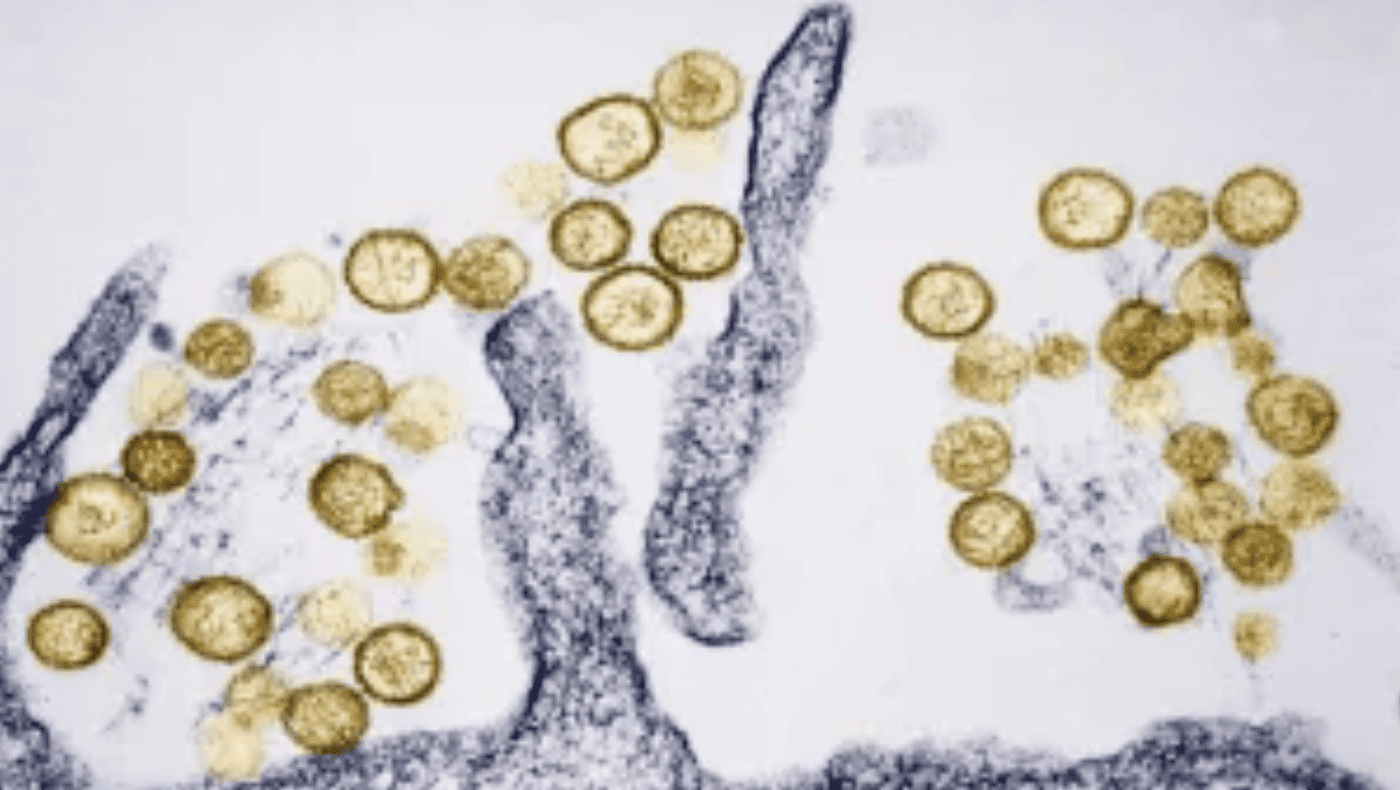 Colorado Hantavirus Fatality Unrelated to Cruise Ship Outbreak, Officials Confirm