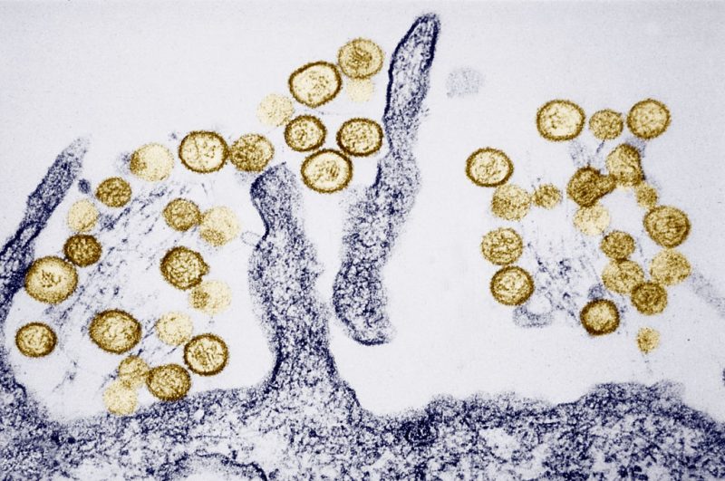 Hantavirus Outbreak on Cruise Ship Kills Three; WHO Downplays Pandemic Risk