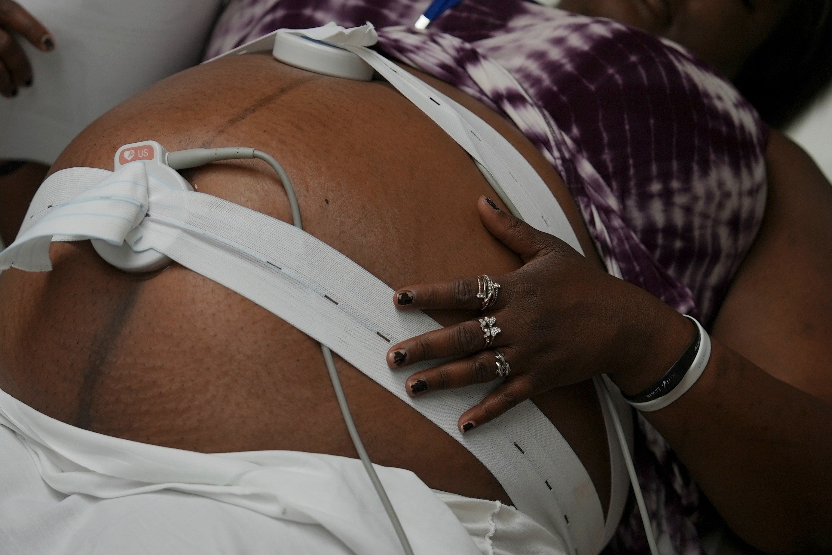 Maternal Mortality: A Rare Bipartisan Consensus Emerges