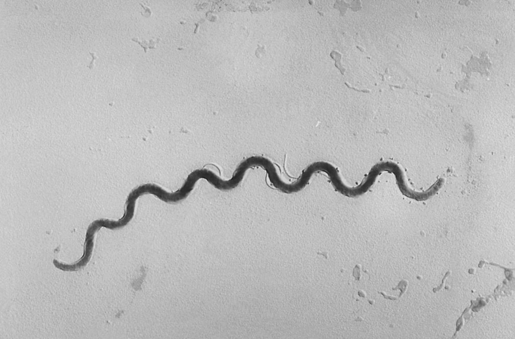 Syphilis Surges 700% in a Decade: CDC Maps the Counties Most at Risk