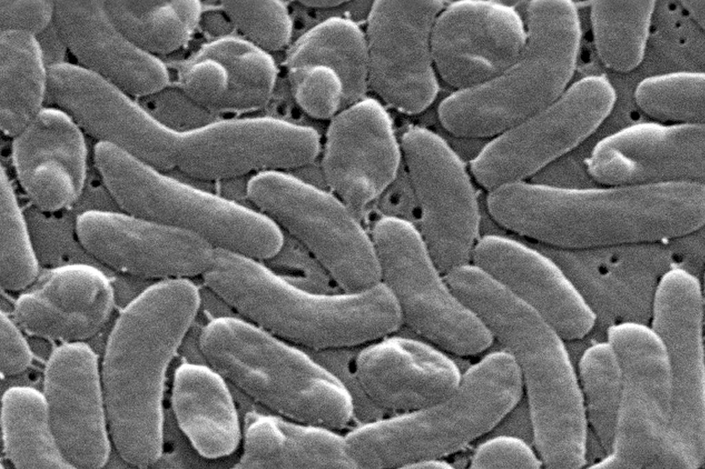 Vibrio Deaths Rise in South as Officials Warn of Flesh-Eating Risk